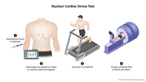 is nuclear stress test hard on kidneys|stress testing for ckd patients.